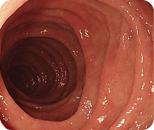 上部消化管内視鏡検査