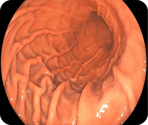 上部消化管内視鏡検査