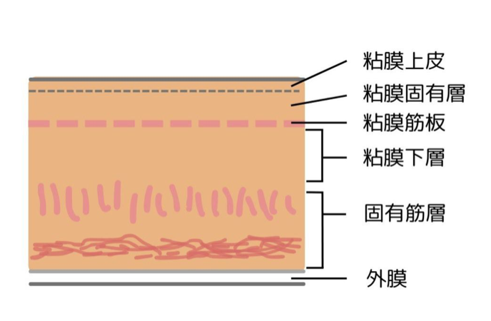 進行度の分類